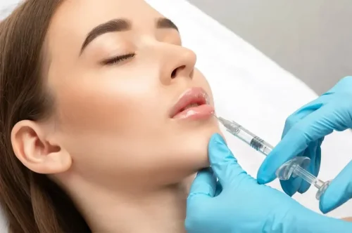 همه چیز درباره تزریق فیلر لب